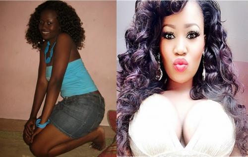 Vera Sidika - Before and After